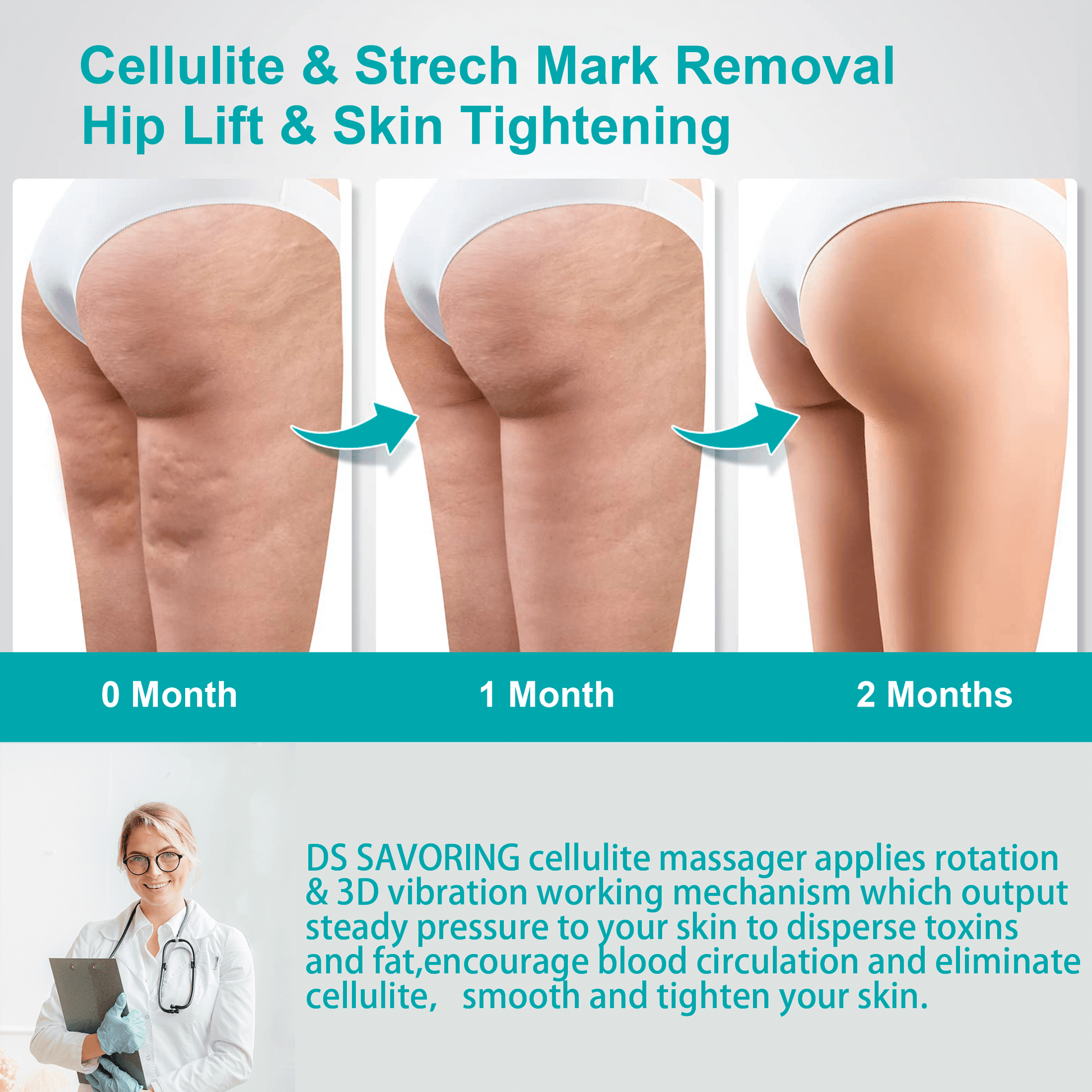 Cellulite Massager Electric Fat Remover, Body Sculpt Massager,Massage dssavoring Cellulite Massager Electric Fat Remover, Body Sculpt Massager,Massage dssavoring